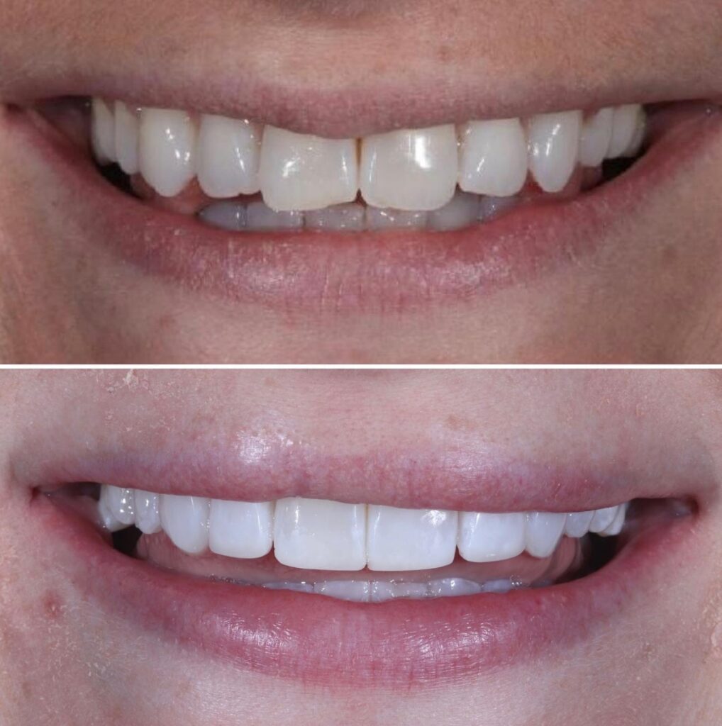 Smile Event Maylands Dental and Aesthetic Practice Dentist in Hemel